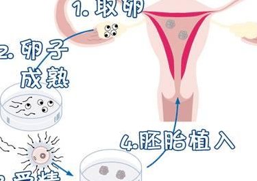 2026云南省大理市十大助孕机构大盘点，知名助孕公司推荐