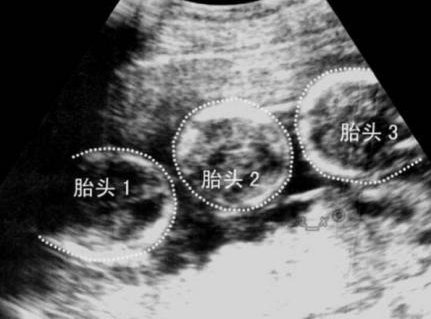 2026四川成都助孕行业领先机构名单公开，详解前十联系方式